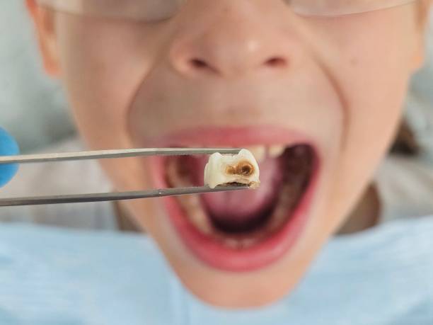 Best Broken Tooth Emergency  in East Providence, RI